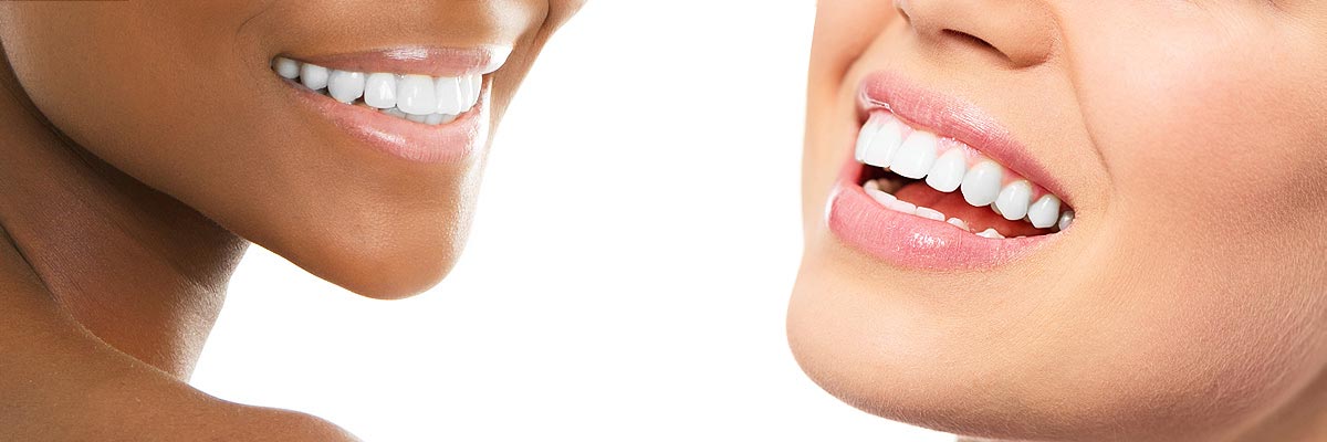 Visalia Teeth Whitening