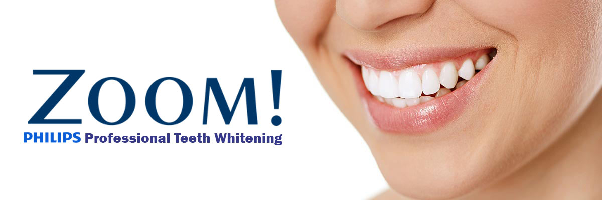 Visalia Zoom Teeth Whitening